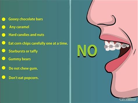 tits braces|10 Things to Avoid When Wearing Braces